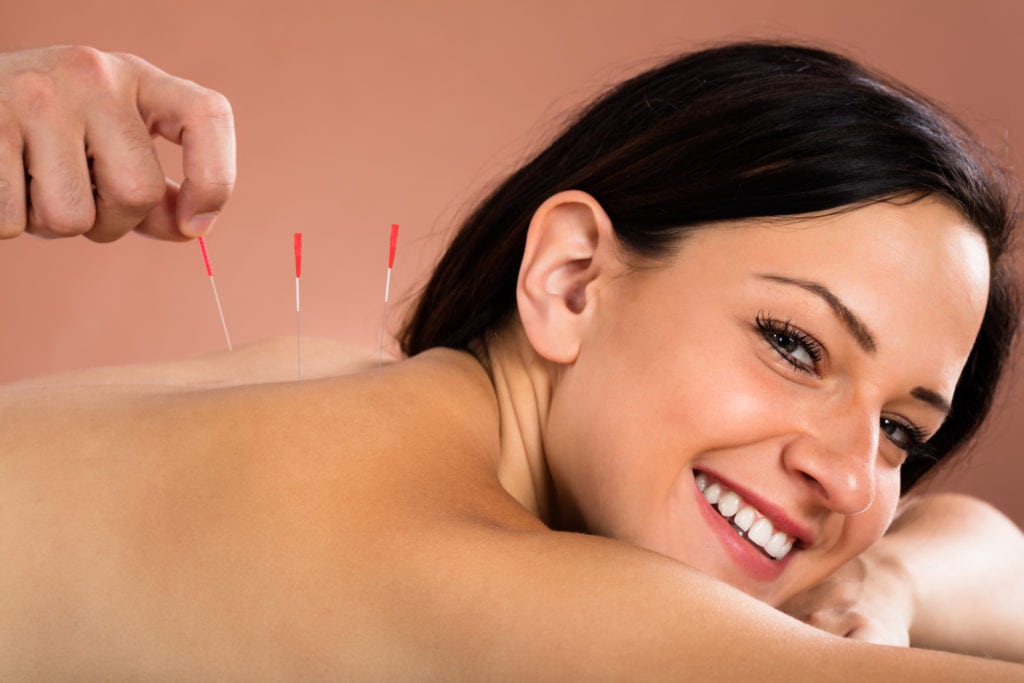 Close-Up Of A Smiling Young Woman Receiving Acupuncture Treatment In Spa